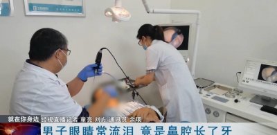 ​令医生惊呆！武汉男子鼻腔竟长出牙齿！