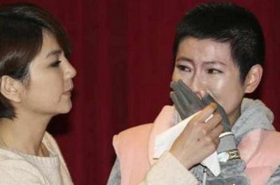 ​SHE的Selina任家萱经过7年不断整容，疤痕修复越来越好