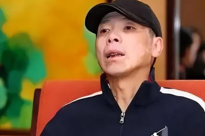 ​冯小刚多年白癜风病症消失！脸上光溜模样变化大，自称没吃任何药