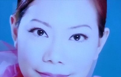 ​“整容达人”斯容：20余年整60多次，削骨导致烂牙，从不后悔