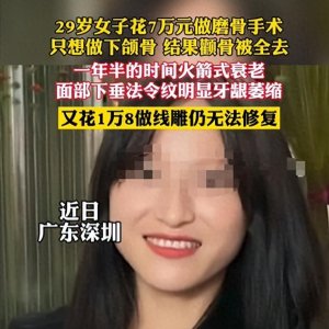 ​磨骨手术：美丽的代价？女子7万整容后加速衰老，值得同情吗？