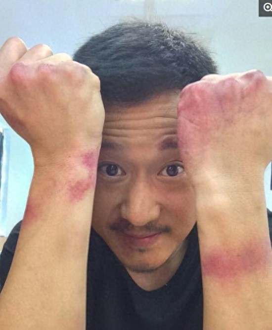 吴京的《战狼2》火了，却没人注意到他左手断掉的大拇指